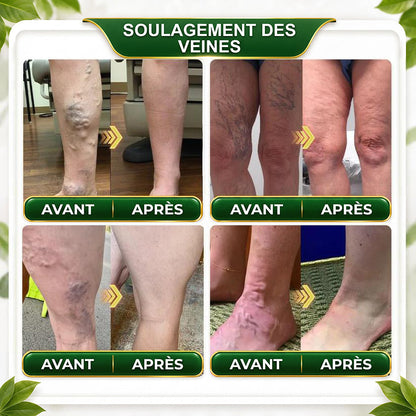 ☘️𝑮𝒓𝒆𝒆𝒏𝑭𝒆𝒆𝒍® 𝑩𝒆𝒓𝒃𝒆𝒓𝒊𝒏𝒆 𝑴𝒐𝒓𝒊𝒏𝒈𝒂- 𝑩𝒆𝒆 𝑽𝒆𝒏𝒐𝒎 𝑫𝒆𝒕𝒐𝒙 𝑺𝒍𝒊𝒎𝒎𝒊𝒏𝒈 𝑭𝒐𝒐𝒕 𝑺𝒐𝒂𝒌 𝑩𝒆𝒂𝒅 𝑼𝒏𝒕𝒆𝒓𝒔𝒕ü𝒕𝒛𝒕 𝑮𝒆𝒘𝒊𝒄𝒉𝒕𝒔𝒎𝒂𝒏𝒂𝒈𝒆𝒎𝒆𝒏𝒕, 𝑳𝒚𝒎𝒑𝒉𝒅𝒓𝒂𝒊𝒏𝒂𝒈𝒆, 𝑮𝒆𝒔𝒖𝒏𝒅𝒆 𝑫𝒖𝒓𝒄𝒉𝒃𝒍𝒖𝒕𝒖𝒏𝒈, 𝑾𝒆𝒊𝒃𝒍𝒊𝒄𝒉𝒆𝒔 𝑾𝒐𝒉𝒍𝒃𝒆𝒇𝒊𝒏𝒅𝒆𝒏 & 𝑺𝒕𝒓𝒂𝒇𝒇𝒆𝒓 𝑨𝒖𝒔𝒔𝒆𝒉𝒆𝒏𝒅𝒆 𝑯𝒂𝒖𝒕🔥