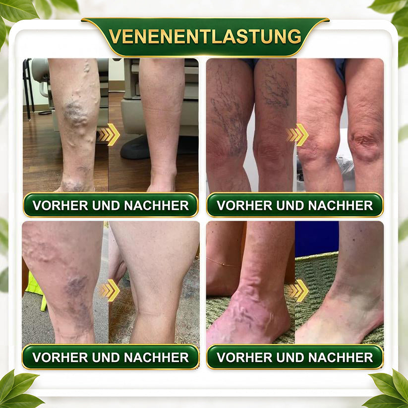 ☘️ GreenFeel® Berbérine, Moringa & Venin d’Abeille – Perles Détox Minceur pour Bain de Pieds, soutenant la gestion du poids, le drainage lymphatique, une circulation saine, le bien-être féminin et une peau visiblement plus ferme. 🔥
