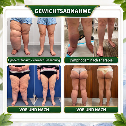 ☘️𝑮𝒓𝒆𝒆𝒏𝑭𝒆𝒆𝒍® 𝑩𝒆𝒓𝒃𝒆𝒓𝒊𝒏𝒆 𝑴𝒐𝒓𝒊𝒏𝒈𝒂- 𝑩𝒆𝒆 𝑽𝒆𝒏𝒐𝒎 𝑫𝒆𝒕𝒐𝒙 𝑺𝒍𝒊𝒎𝒎𝒊𝒏𝒈 𝑭𝒐𝒐𝒕 𝑺𝒐𝒂𝒌 𝑩𝒆𝒂𝒅 𝑼𝒏𝒕𝒆𝒓𝒔𝒕ü𝒕𝒛𝒕 𝑮𝒆𝒘𝒊𝒄𝒉𝒕𝒔𝒎𝒂𝒏𝒂𝒈𝒆𝒎𝒆𝒏𝒕, 𝑳𝒚𝒎𝒑𝒉𝒅𝒓𝒂𝒊𝒏𝒂𝒈𝒆, 𝑮𝒆𝒔𝒖𝒏𝒅𝒆 𝑫𝒖𝒓𝒄𝒉𝒃𝒍𝒖𝒕𝒖𝒏𝒈, 𝑾𝒆𝒊𝒃𝒍𝒊𝒄𝒉𝒆𝒔 𝑾𝒐𝒉𝒍𝒃𝒆𝒇𝒊𝒏𝒅𝒆𝒏 & 𝑺𝒕𝒓𝒂𝒇𝒇𝒆𝒓 𝑨𝒖𝒔𝒔𝒆𝒉𝒆𝒏𝒅𝒆 𝑯𝒂𝒖𝒕🔥