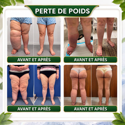 ☘️ GreenFeel® Berbérine, Moringa & Venin d’Abeille – Perles Détox Minceur pour Bain de Pieds, soutenant la gestion du poids, le drainage lymphatique, une circulation saine, le bien-être féminin et une peau visiblement plus ferme. 🔥