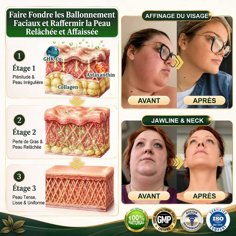 ☘️𝑮𝒓𝒆𝒆𝒏𝑭𝒆𝒆𝒍® 𝑩𝒆𝒓𝒃𝒆𝒓𝒊𝒏𝒆 𝑴𝒐𝒓𝒊𝒏𝒈𝒂- 𝑩𝒆𝒆 𝑽𝒆𝒏𝒐𝒎 𝑫𝒆𝒕𝒐𝒙 𝑺𝒍𝒊𝒎𝒎𝒊𝒏𝒈 𝑭𝒐𝒐𝒕 𝑺𝒐𝒂𝒌 𝑩𝒆𝒂𝒅 𝑼𝒏𝒕𝒆𝒓𝒔𝒕ü𝒕𝒛𝒕 𝑮𝒆𝒘𝒊𝒄𝒉𝒕𝒔𝒎𝒂𝒏𝒂𝒈𝒆𝒎𝒆𝒏𝒕, 𝑳𝒚𝒎𝒑𝒉𝒅𝒓𝒂𝒊𝒏𝒂𝒈𝒆, 𝑮𝒆𝒔𝒖𝒏𝒅𝒆 𝑫𝒖𝒓𝒄𝒉𝒃𝒍𝒖𝒕𝒖𝒏𝒈, 𝑾𝒆𝒊𝒃𝒍𝒊𝒄𝒉𝒆𝒔 𝑾𝒐𝒉𝒍𝒃𝒆𝒇𝒊𝒏𝒅𝒆𝒏 & 𝑺𝒕𝒓𝒂𝒇𝒇𝒆𝒓 𝑨𝒖𝒔𝒔𝒆𝒉𝒆𝒏𝒅𝒆 𝑯𝒂𝒖𝒕🔥