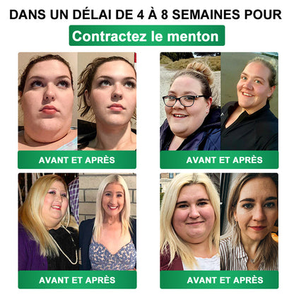 👩‍⚕️ Il ne reste plus que 10 boîtes ! 🎁 Nous offrons une remise supplémentaire de 30 % ! Prenez soin de votre santé ! Si vous manquez cette offre, il n'y en aura plus cette année !